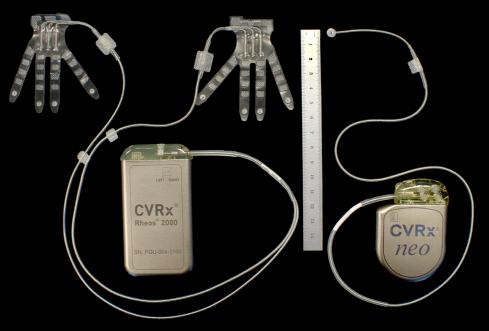 Figure 107.2, This figure compares the original CVRx Rheos device used in the Rheos Pivotal Trial (left) and the second-generation device, Barostim neo (right), from the Barostim neo Trial. Improvements in design included a smaller pulse generator and simplified single lead apparatus designed for unilateral implantation.