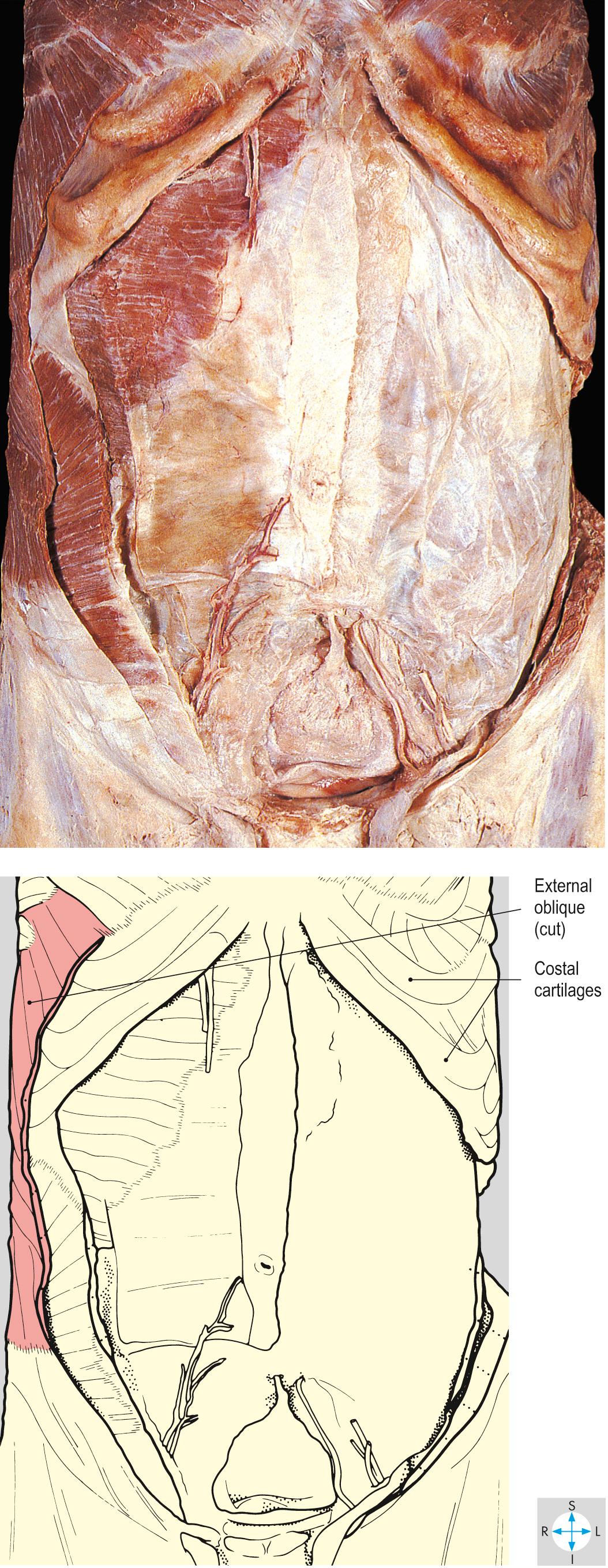 Fig. 1.11, External oblique cut to show its thickness.