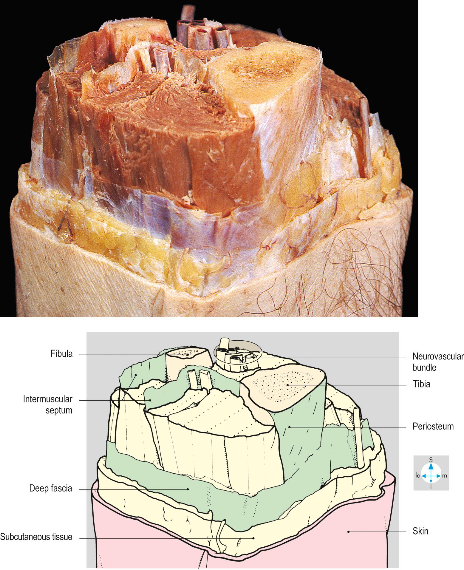 Fig. 1.9, Multilevel ‘step’ dissection through the right midcalf to show layers of skin, fascia and intermuscular septa.