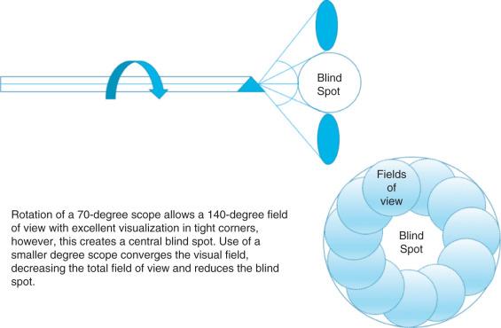 Fig. 8.2, The angulation of each scope determines the field of view as well as the potential blind spot.