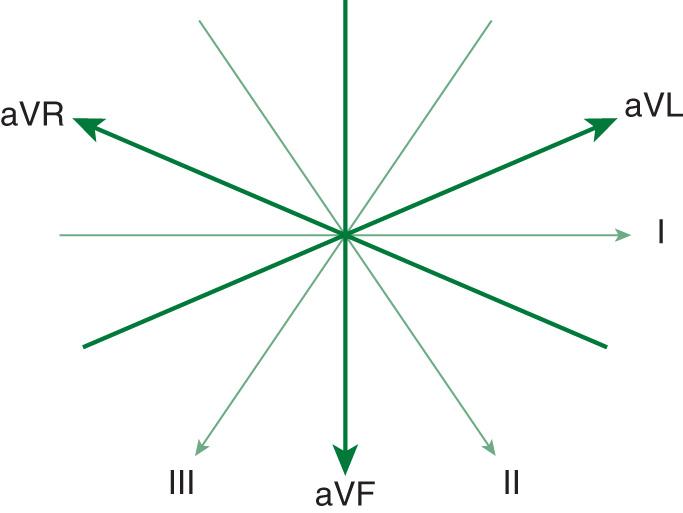 Figure 14.3, Hexaxial system of limb and augmented leads in the frontal plane. Each lead is separated by 30 degrees in this frontal-plane representation of the limb and augmented leads. Augmented leads are shown in boldface. Arrows denote positive polarity. Note that the inferior leads (II, III, aVF) logically lie at the bottom of this figure and the lateral leads (I, aVL) lie on the left side of the figure, where the lateral aspect of the heart is located if this were superimposed on a patient.
