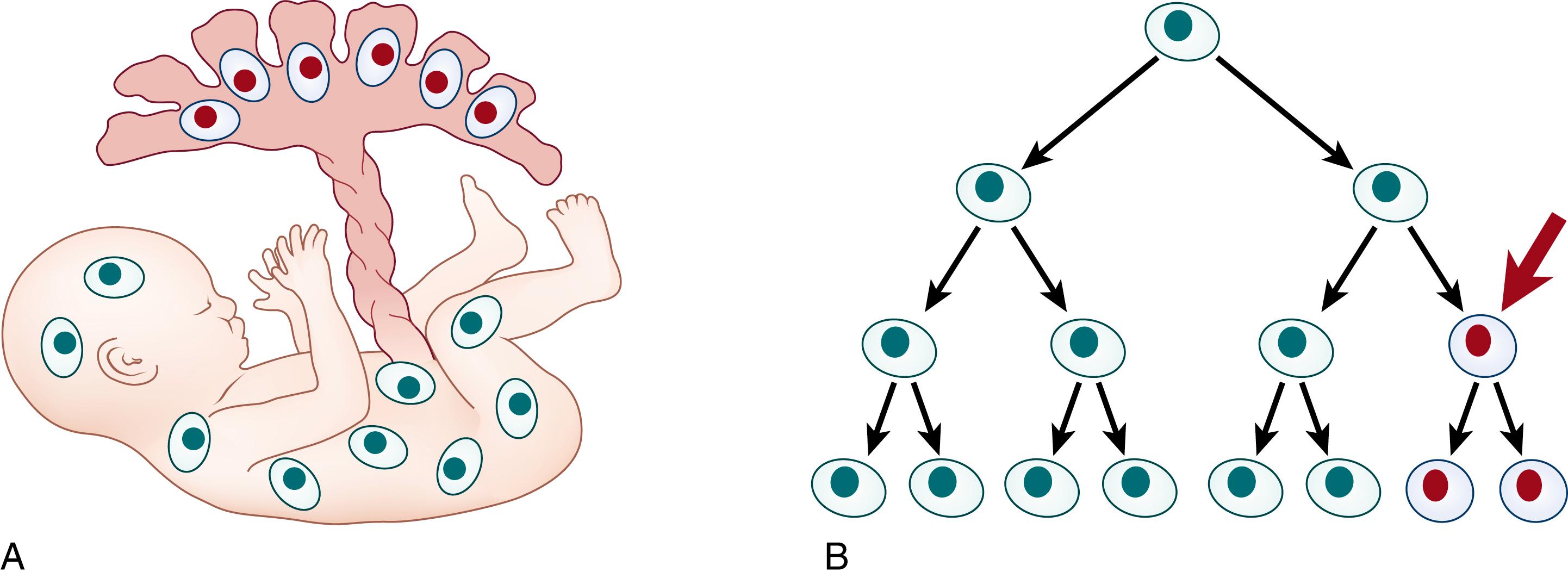 Fig. 1.2, Mosaicism. (A) Confined placental mosaicism. Presence of mutant cells only in the placental tissue, not in the fetus. (B) Somatic mosaicism. Presence of two or more mutant cell lineages in tissues and may have a clinically observable phenotype in the part of the body with the genetic aberration.