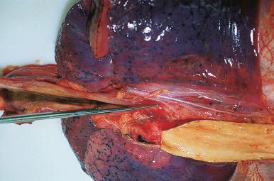 Figure 4-13, The esophagus is opened along its posterior aspect.