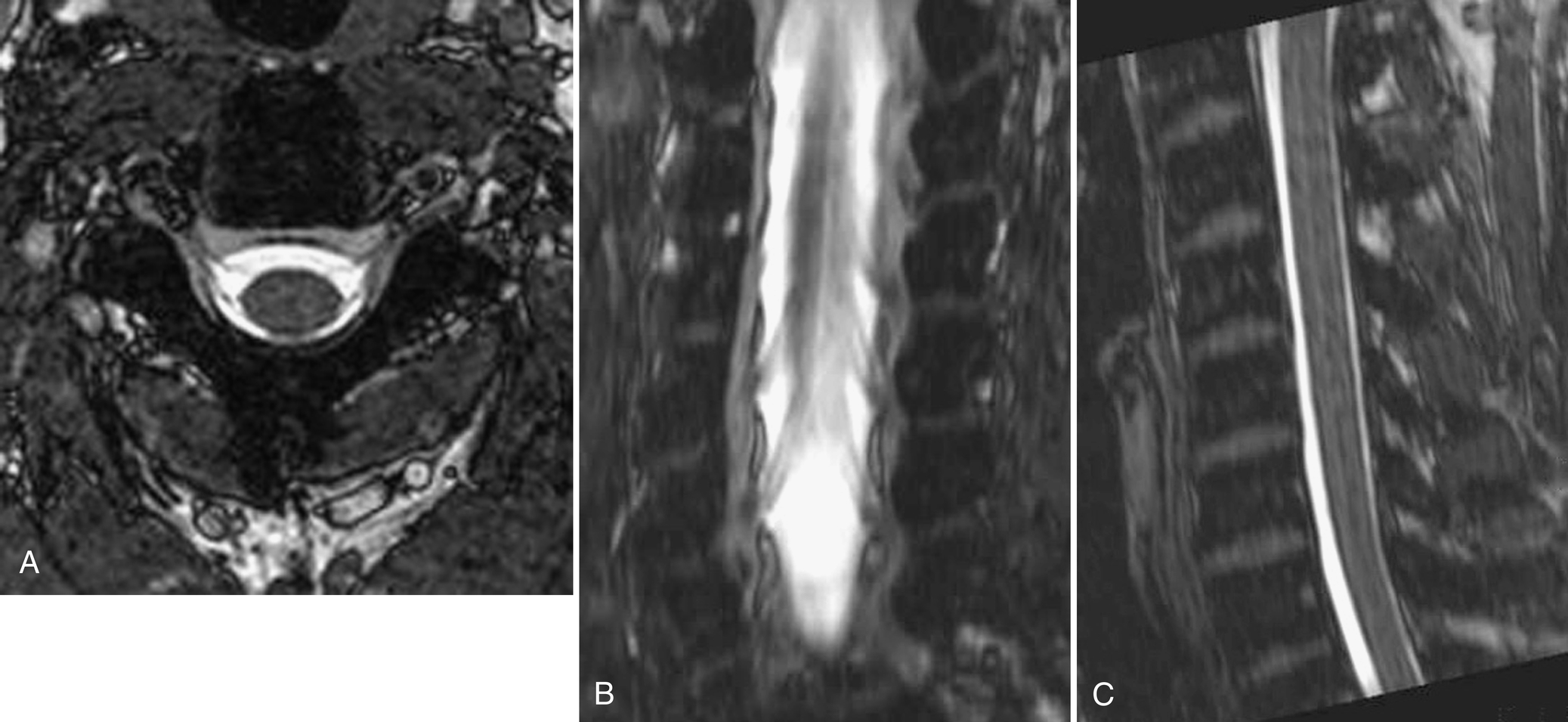 Fig. 1.13, 3D volume imaging.