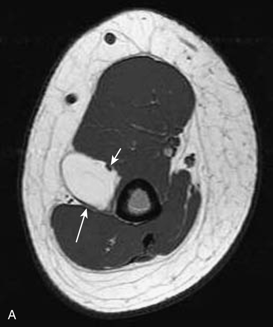 Fig. 1.6, T1-weighted images: high signal intensity tissues.