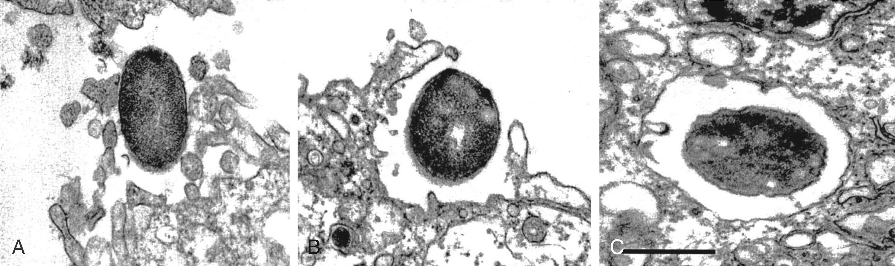 Figure 52.1, Transmission electron micrographs of Escherichia coli .