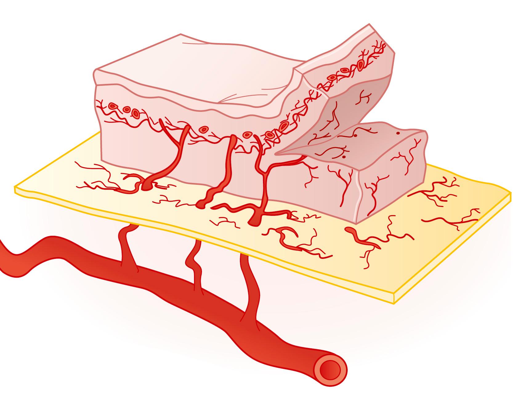 Fig. 2.3, Perforators arise from axial vessels in/directly to supply the overlying soft tissues. Connections between adjacent perforators are by direct connections within the subdermal plexus and indirect connections within the suprafascial plexus.