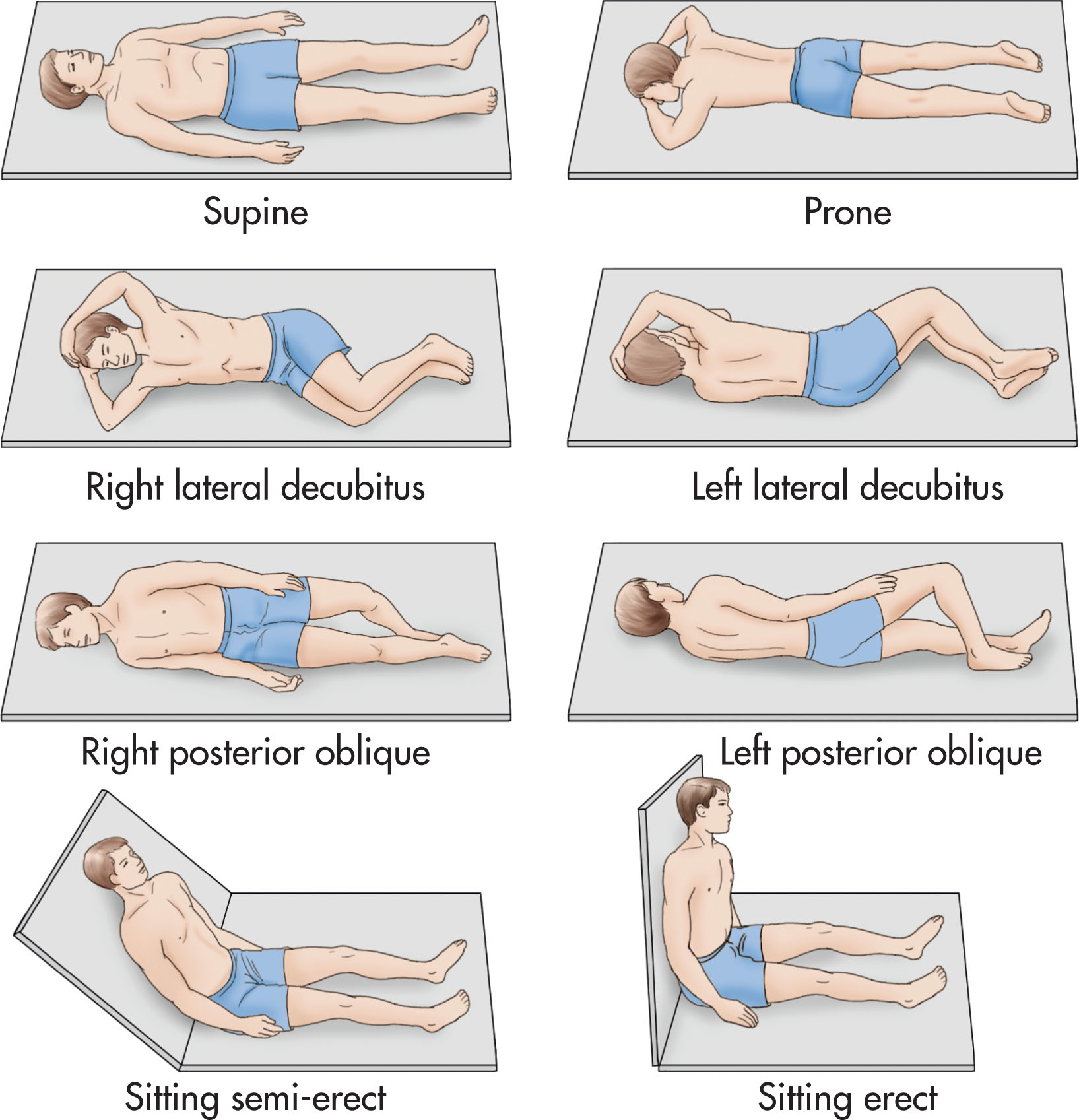 Fig 6.1, Standard patient positions for the ultrasound examination include the supine, prone, decubitus, oblique, and erect positions.