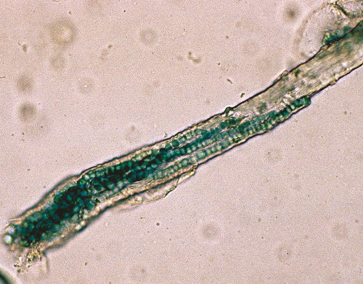 Fig. 2.3, Microscopic examination of a KOH preparation of a hair shaft with an endothrix dermatophyte infection (tinea capitis).