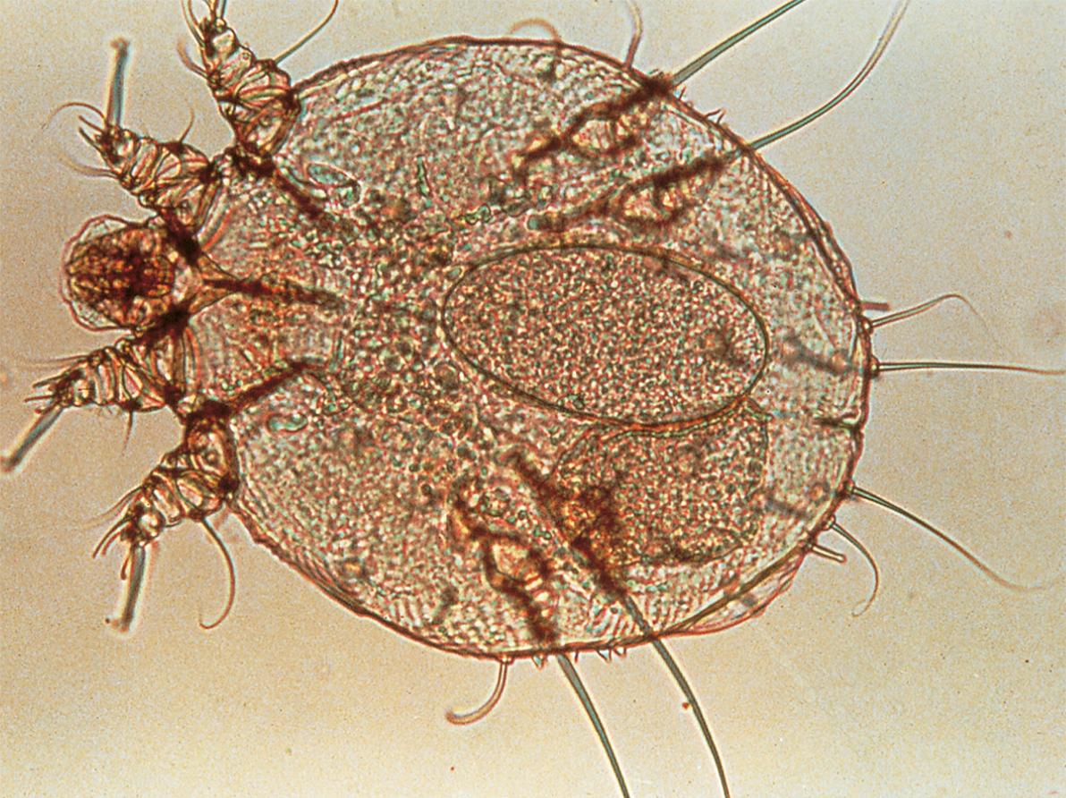 Fig. 2.4, Microscopic examination of scrapings from a patient with scabies.