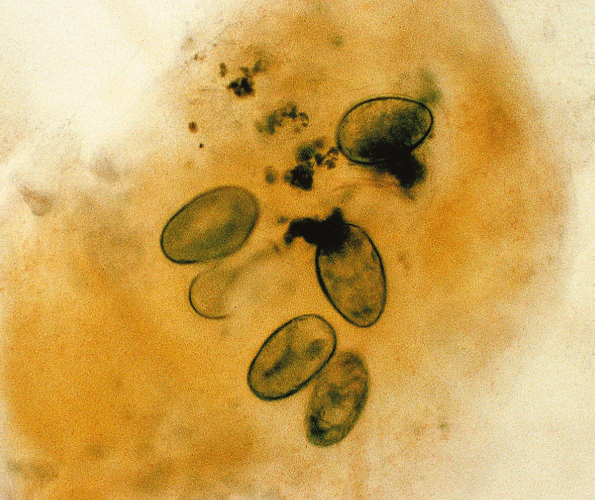 Fig. 2.5, Microscopic examination of scrapings from a patient with scabies.