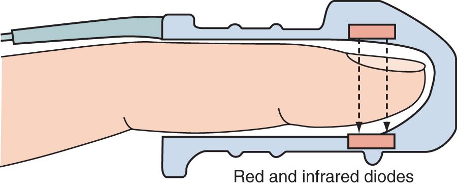 Fig. 33.1, Schematic depiction of the pulse oximeter light absorption signal.