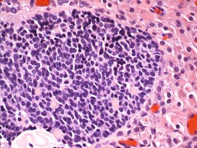 Fig. 22.22, Granulosa cell proliferation in the ovary during pregnancy.