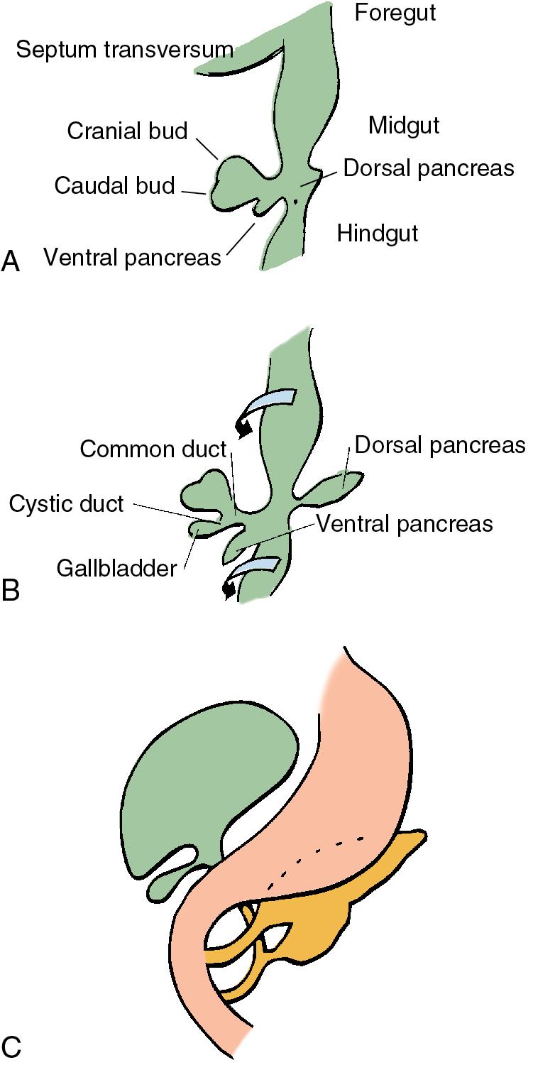 FIGURE 48.1, A, At approximately the fifth week of intrauterine life, a diverticulum evolves near the junction of the midgut and hindgut and grows into the ventral mesogastrium. The ventral pancreatic bud develops from the superior surface as the cranial sacculation and pushes cephalad into the septum transversum. B, The gallbladder and extrahepatic ducts develop from the caudal bud, and the liver develops from the cranial bud. The ventral pancreas evolves in close relationship to the developing common bile duct. C, At the 7-mm stage, left-to-right rotation occurs, resulting in subsequent fusion of the pancreas, gallbladder, duodenum, and extrahepatic bile ducts into their normal anatomic relationship. (See Chapter 1 .)