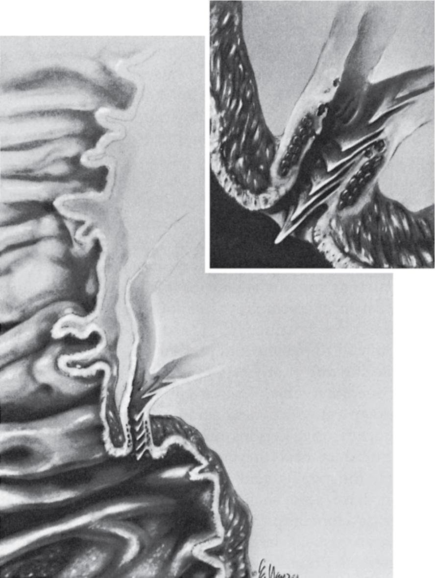 FIGURE 48.2, Artist’s representation of the macroscopic anatomy of the choledochoduodenal junction, depicting the transverse valvules described by Brown and Echenberg (1964) that prevents reflux from the duodenum.