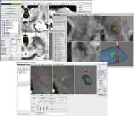 Figure 13.1, Cranialsuite software integrates directly with the clinical flow to collect data and store it in the CranialCloud.