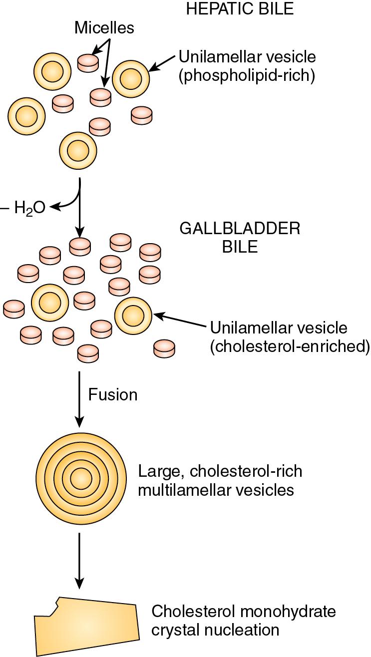 Bile secretion and pathophysiology of biliary tract obstruction ... Biology Diagrams