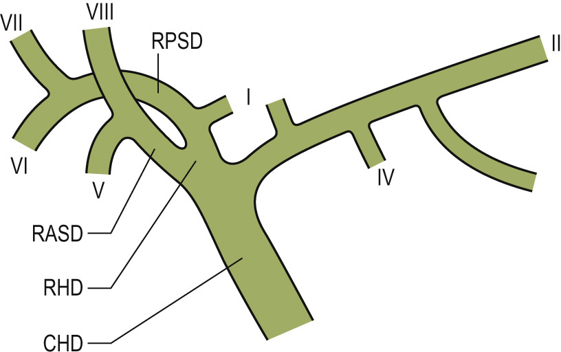 Typical pattern of intrahepatic biliary branching. Segments are numbered according to the system of Couinaud. CHD = common hepatic duct, RHD = right hepatic duct, LHD = left hepatic duct, RPSD = right posterior sectoral duct, RASD = right anterior sectoral duct. **