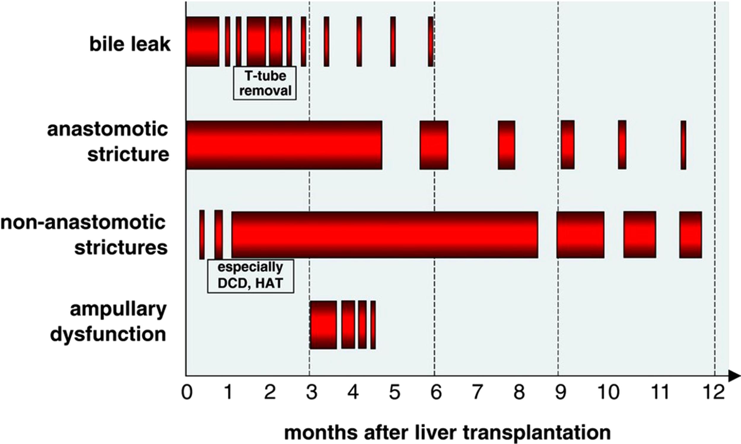 Fig. 21.1, Typical manifestation period of different biliary complications.