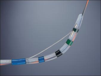 FIG 17.1, Smooth, tapered, rounded, polished tip of a sphincterotome with colored markers that allow for determination of the depth of insertion. A preloaded guidewire with a hydrophilic tip is helpful for selective cannulation. An integrated hub can be used for injection of contrast media without the need for guidewire removal.