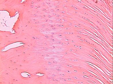 FIG 5-1, Histology of native anterior cruciate ligament insertion to bone. Examination shows interdigitation of the collagen fibers with bone through four distinct transition zones: tendon, unmineralized fibrocartilage, mineralized fibrocartilage, and bone.