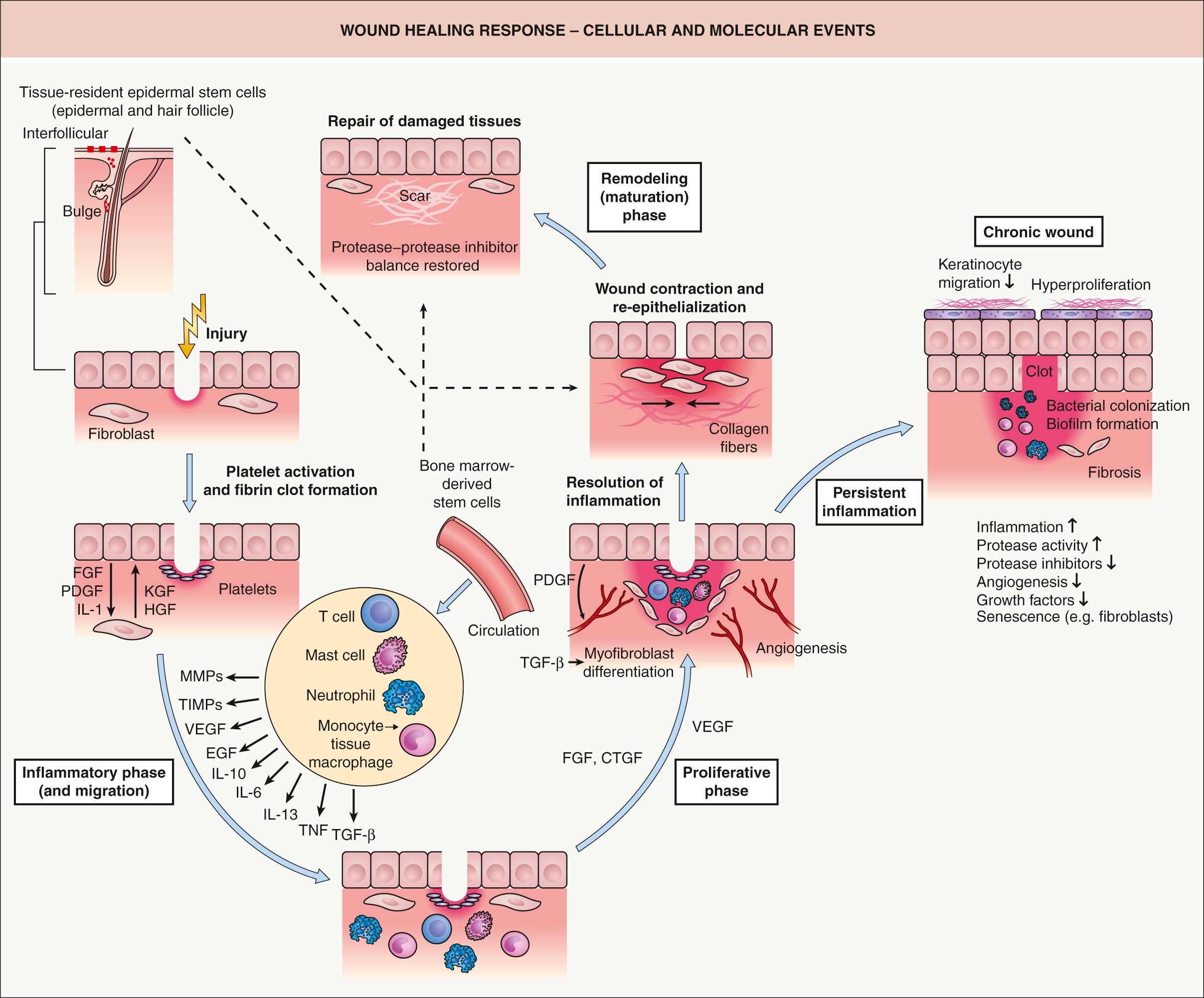 Fig. 141.3, Wound healing response – cellular and molecular events.