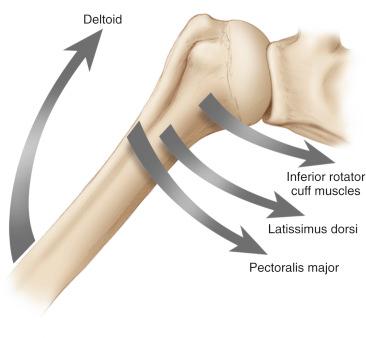 FIG. 3.1, The coronal plane force couple with the deltoid acting superiorly and the inferior rotator cuff (subscapularis, infraspinatus, teres minor), pectoralis major, and latissimus dorsi acting inferiorly.