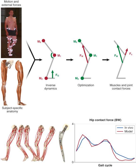 Fig. 2.1, Schematic representation of patient-specific determination of internal loading conditions. Gait analysis data are recorded for a subject, together with limb segment positions from which velocities and accelerations are determined (upper left). Key anatomic measures of the patient's anatomy can be derived from medical imaging data, resulting in a patient-specific musculoskeletal model (lower left). Combining these data in an inverse dynamics approach provides access to intersegmental resultant joint moments. Muscle and joint contact forces are then calculated using an optimization algorithm, which minimizes the sum of muscle forces to balance these moments (upper right). To validate the predictions of the musculoskeletal model, hip contact forces calculated for individual gait cycles of 4 patients were compared directly with corresponding in vivo forces measured with telemetric hip implants (lower right).