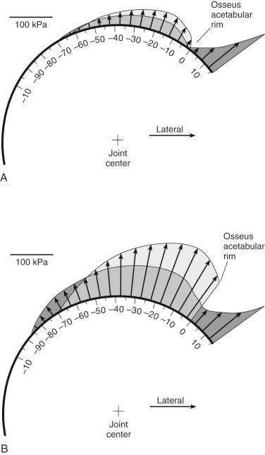 Fig. 1.3, Predicted distribution of cartilage contact stresses at (A) 1000 seconds and (B) 10,000 seconds after load application with (dark gray) and without the labrum (light gray).
