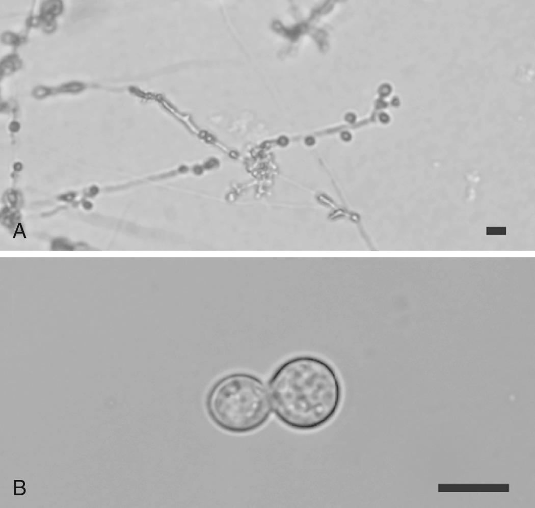 FIG. 264.1, Blastomyces hyphae and yeast.