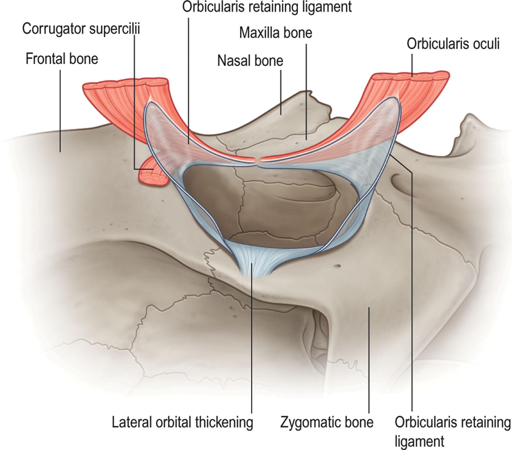 Figure 13.12, The orbicularis muscle fascia attaches to the skeleton along the orbital rim by the lateral orbital thickening in continuity with the orbicularis retaining ligament.