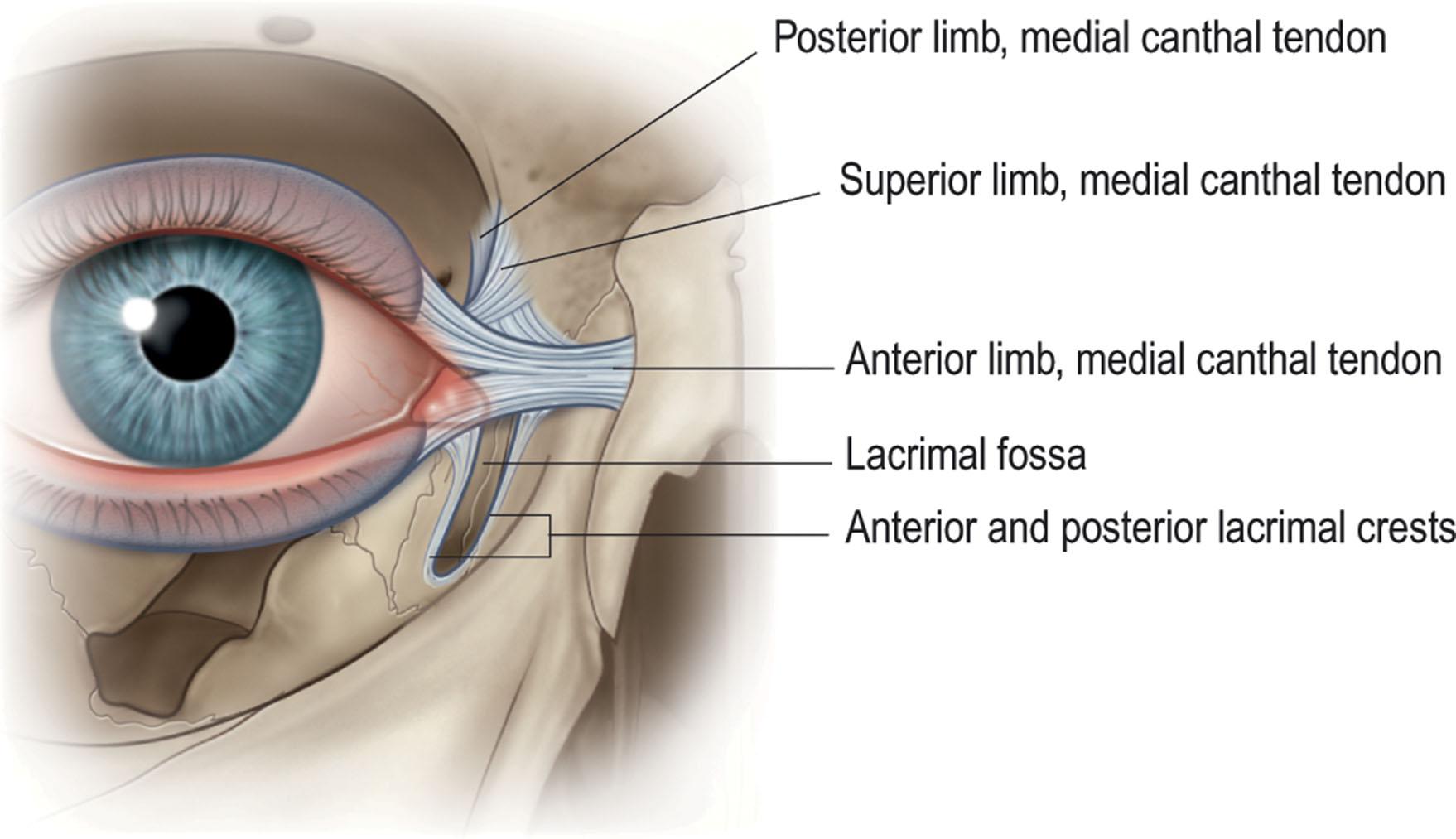 Figure 13.5, The medial canthal tendon envelops the lacrimal sac. It is tripartite, with anterior, posterior, and superior limbs. Like the lateral canthal tendon, its limbs are continuous with tarsal plates. The components of this tendon along with its lateral counterpart are enveloped by deep and superficial aspects of the orbicularis muscle.