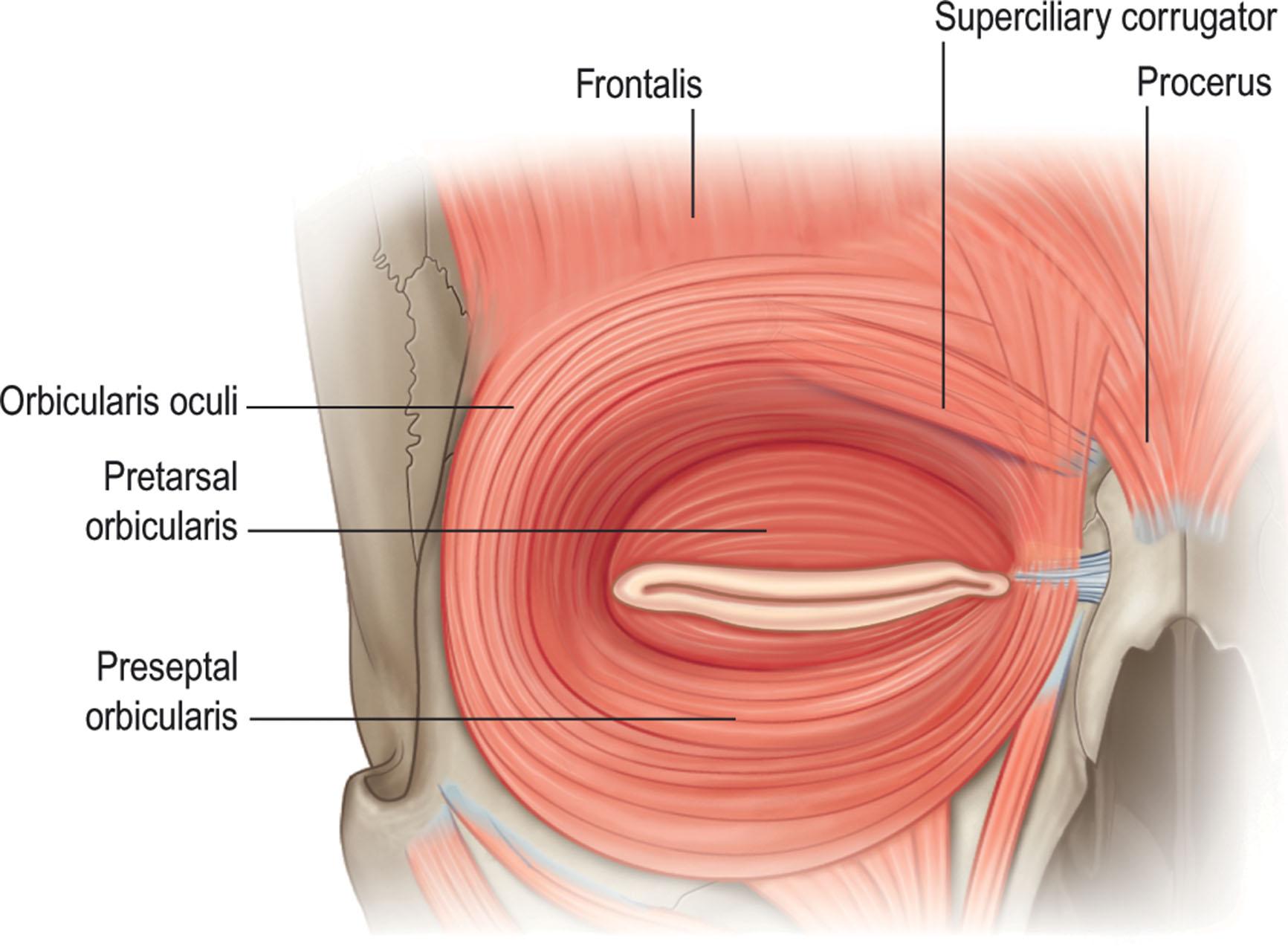 Figure 13.6, Facial muscles of the orbital region. Note that the preseptal and pretarsal orbicularis muscles fuse with the medial and lateral canthal tendons.