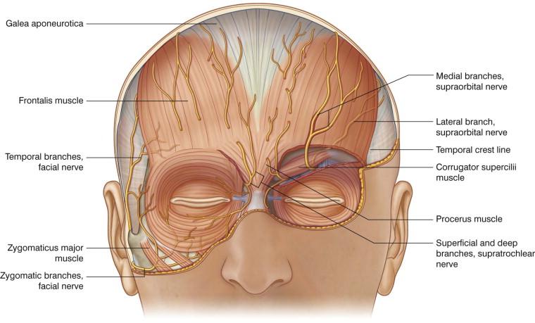 FIGURE 40.2, Periorbital and eyelid muscles and their relationship with local nerves.