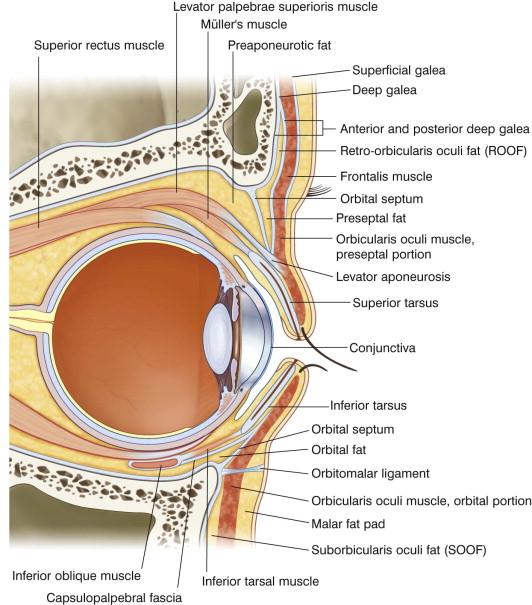 FIGURE 40.3, Cross-sectional anatomy of upper and lower eyelids in non-Hispanic whites.