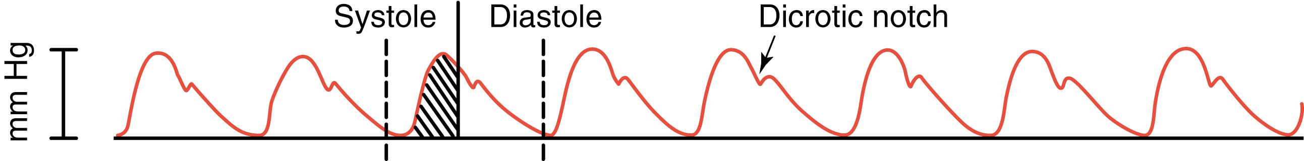 FIG. 16.5, Diagram of usual pulse.