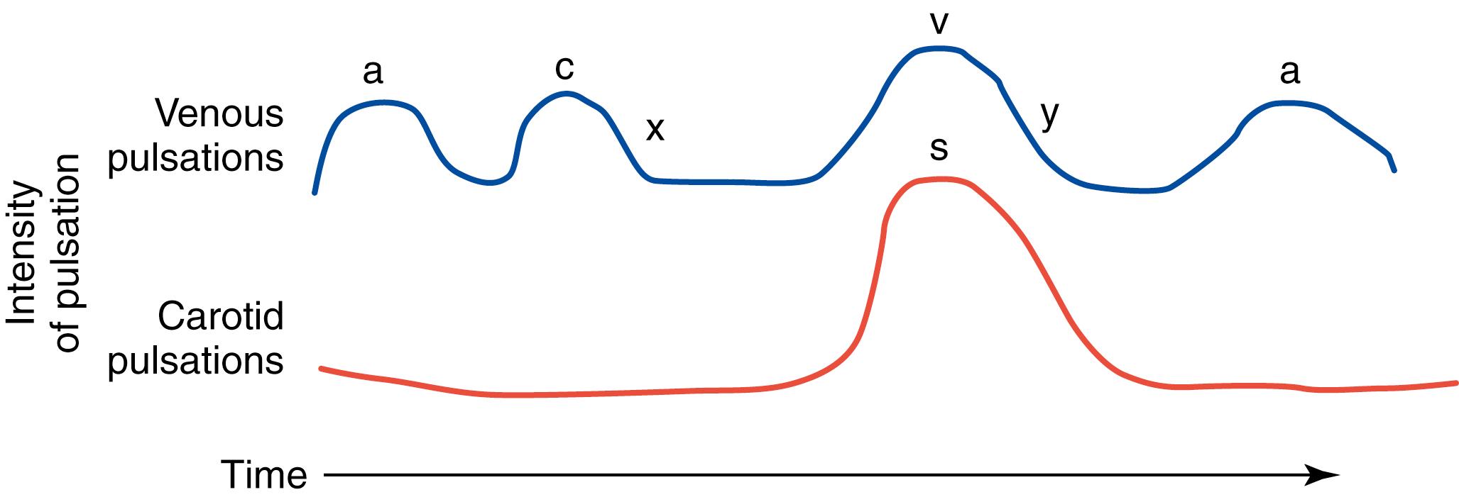 FIG. 16.7, Expected venous pulsations.