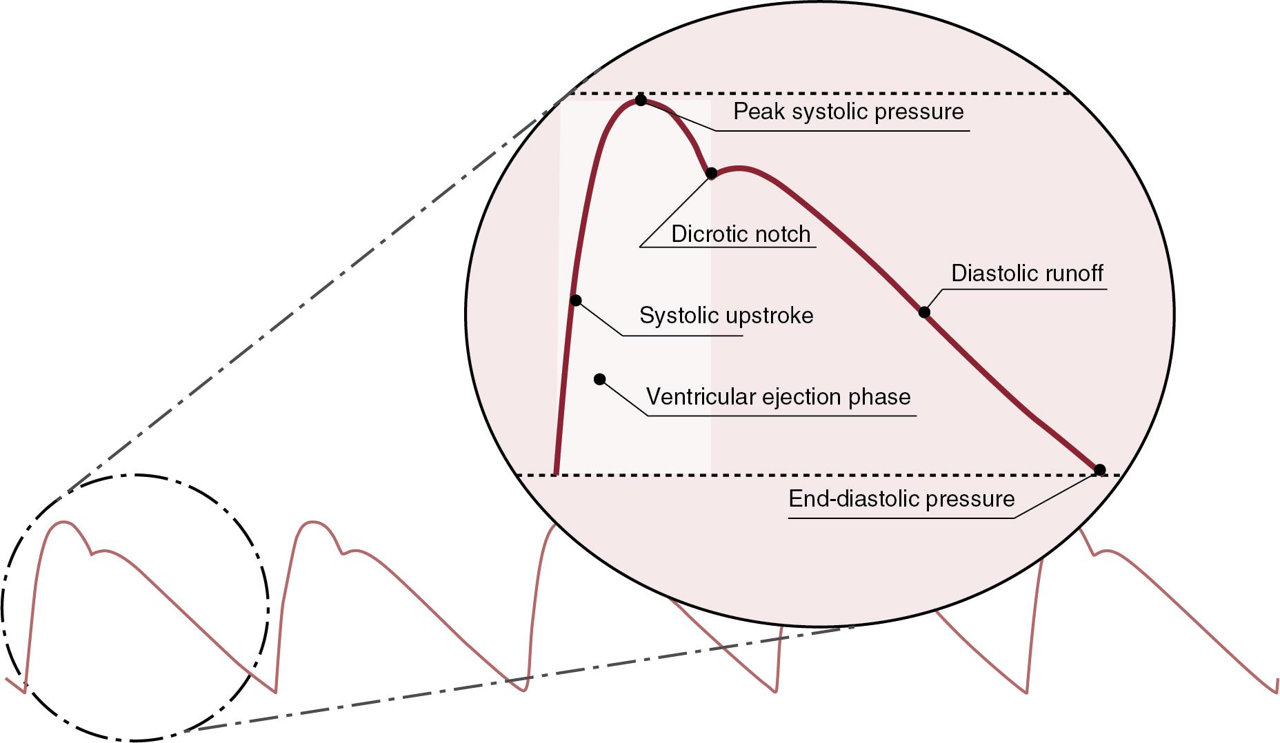 Fig. 3.1, The arterial pressure waveform characterized by the upstroke (anacrotic) and downstroke (dicrotic) limbs.