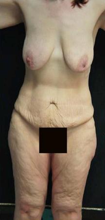 FIGURE 34.1, The clinical problem.