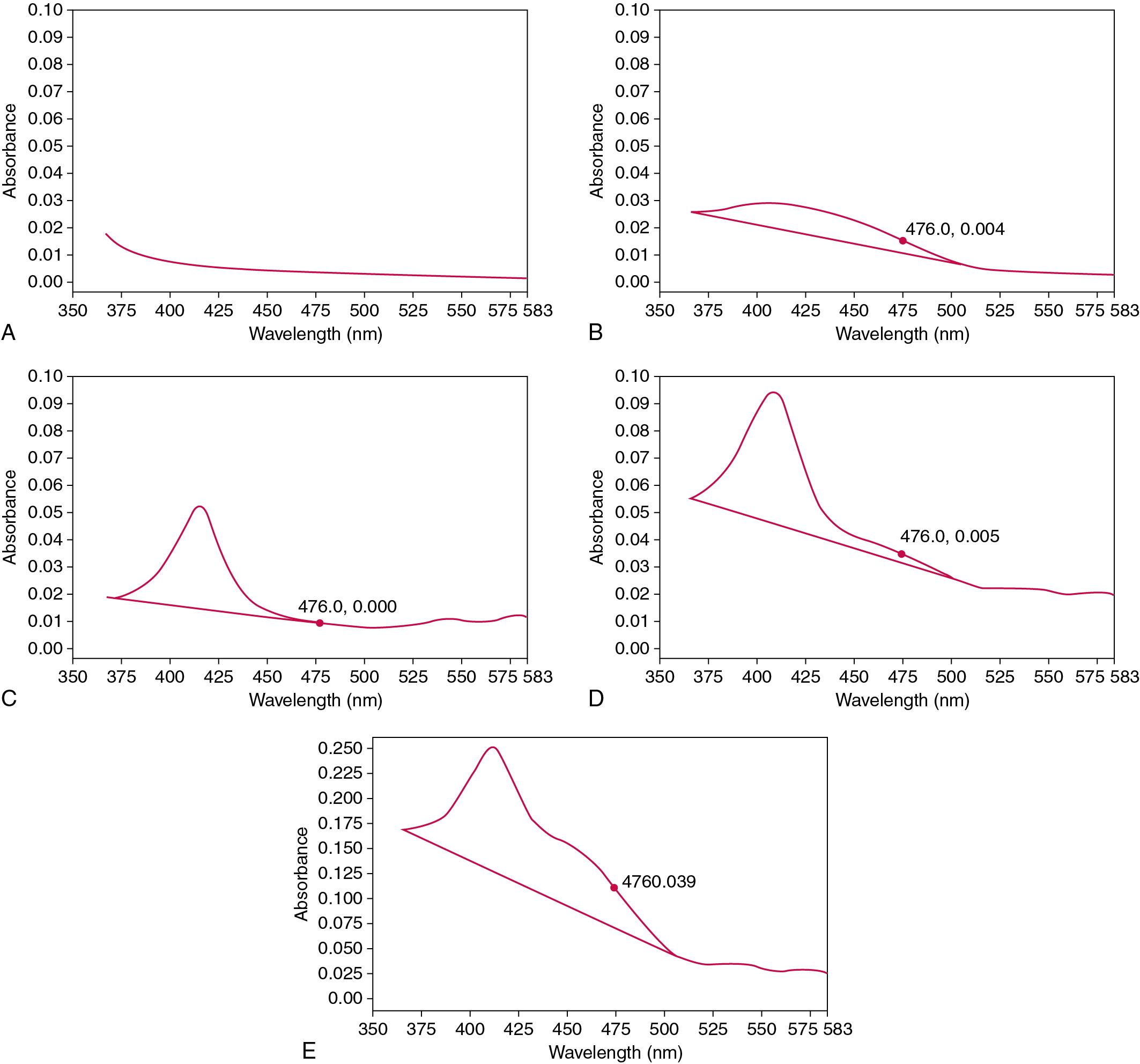 FIGURE 45.9, Representative spectrophotometric scans showing net bilirubin absorbance (NBA) at 476 nm above a tangential baseline, as described in the text. (A) Normal cerebrospinal fluid with essentially no bilirubin; scan and baseline (not drawn) are superimposable. (B) NBA within the reference range. (C) Oxyhemoglobin with zero NBA. (D) Oxyhemoglobin with NBA within the reference range. (E) Oxyhemoglobin with an increased NBA.