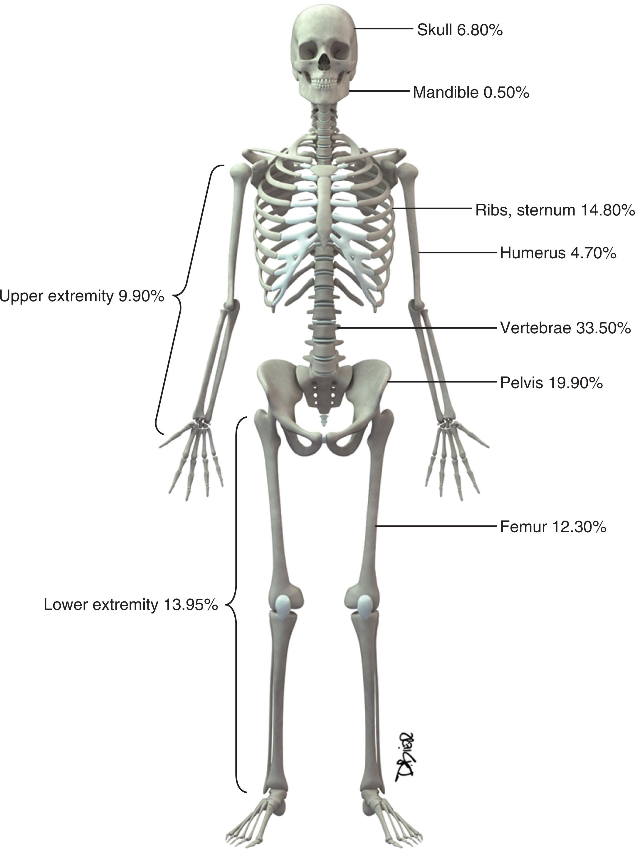 Figure 34.1, Distribution of bone metastases. Data are from a study of 2001 patients with 4105 bone metastases. The lesions were counted on the basis of a combination of anatomic sites and individual bones. The entire spine, all ribs, and the entire bony pelvis were each considered one anatomic site, and one or numerous metastases to these areas were counted as one lesion. Long-bone metastases were counted per bone. This is a common method of tallying bone metastases that can lead to a relative underrepresentation of axial metastases. Only 0.7% of the metastases in the study were unspecified.