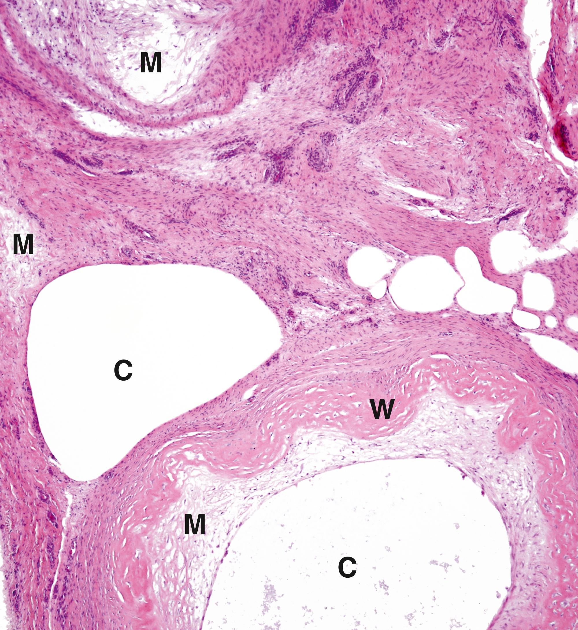 Fig. 22.13, Ganglion (LP).