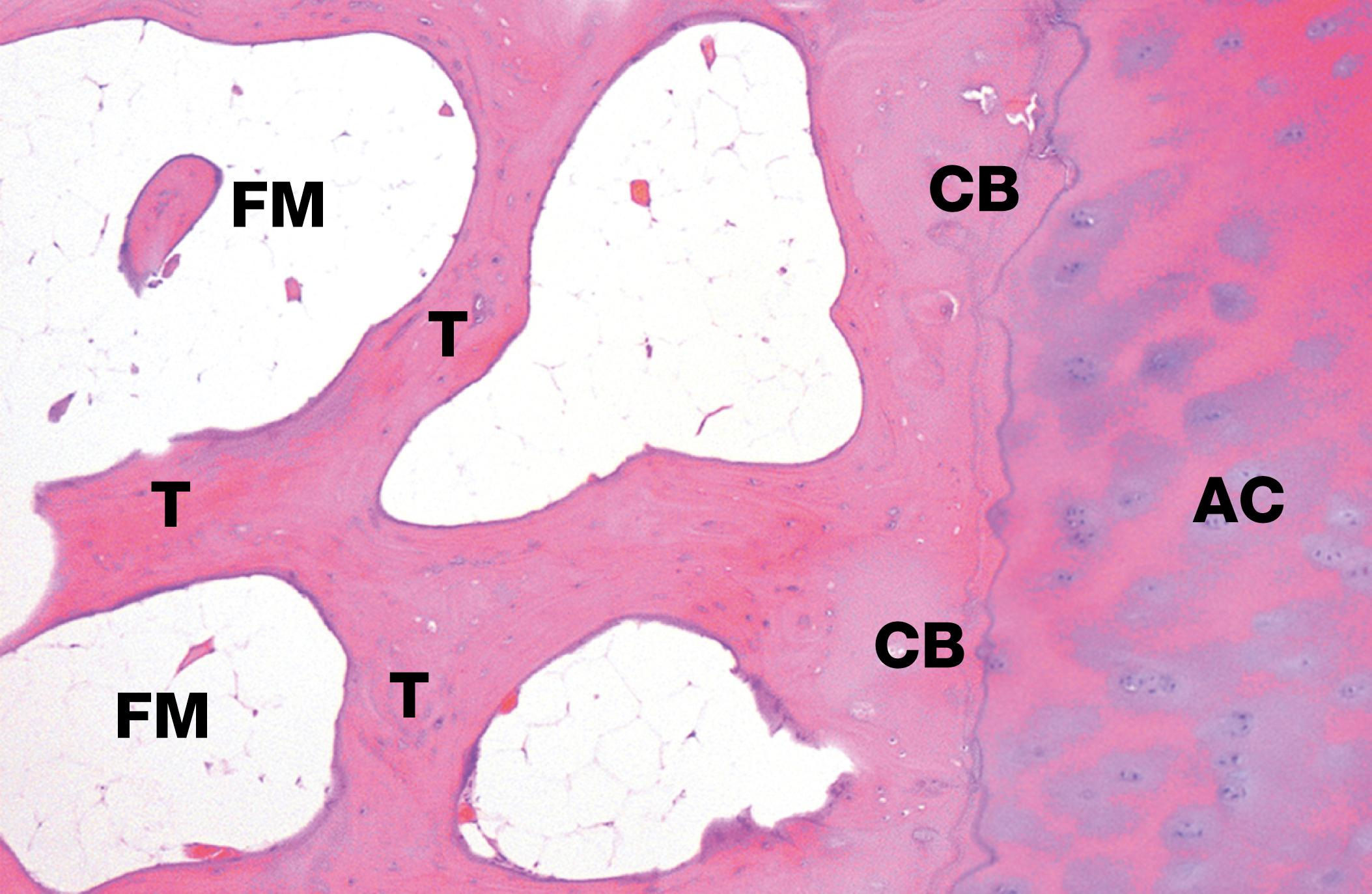 E-Fig. 22.1 H, Bone, cortical and trabecular H&E (LP).