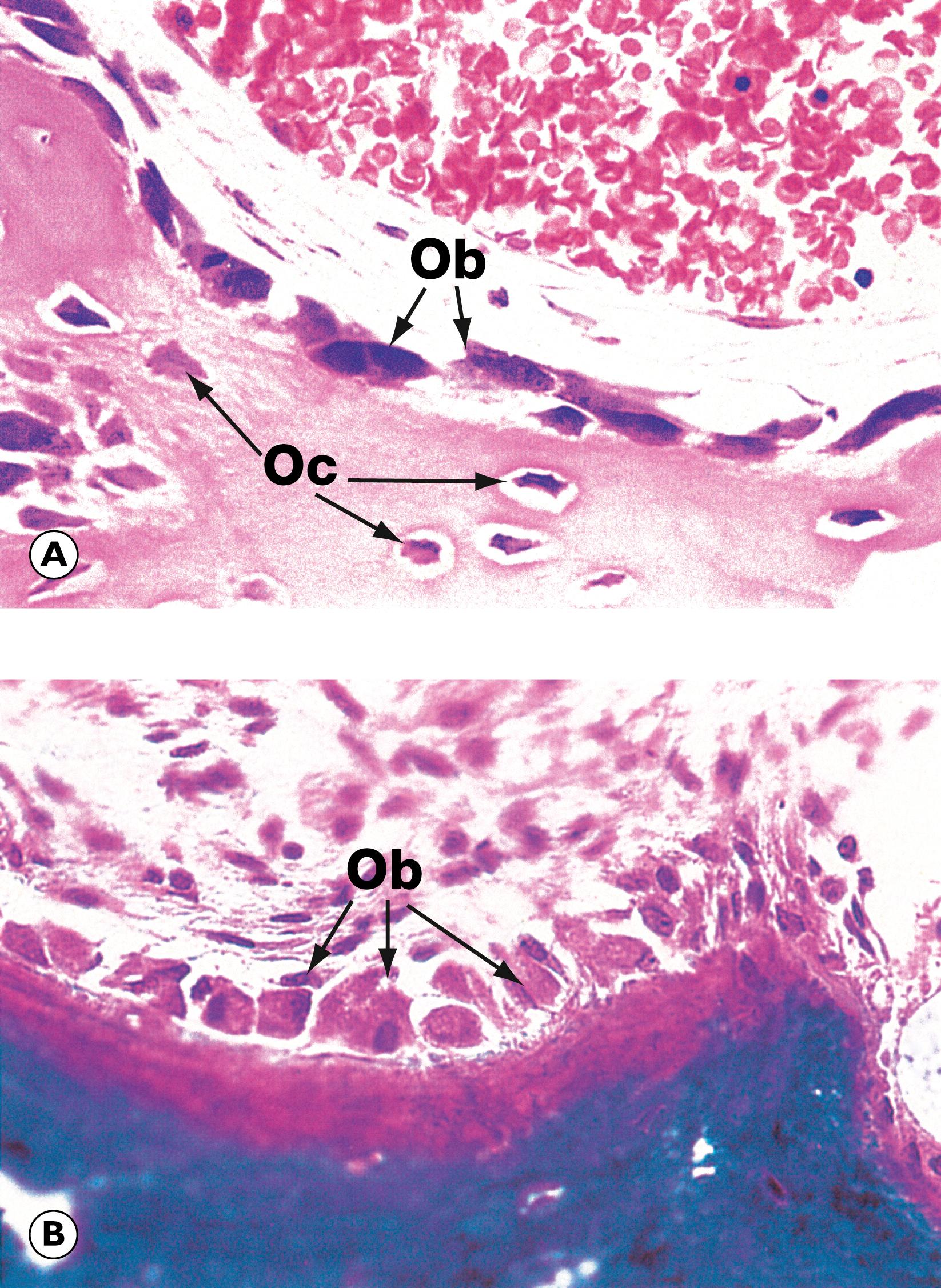 E-Fig. 22.2 H, Active osteoblasts and osteoid. (A) H&E (HP); (B) undecalcified resin section, Goldner trichrome stain (HP).