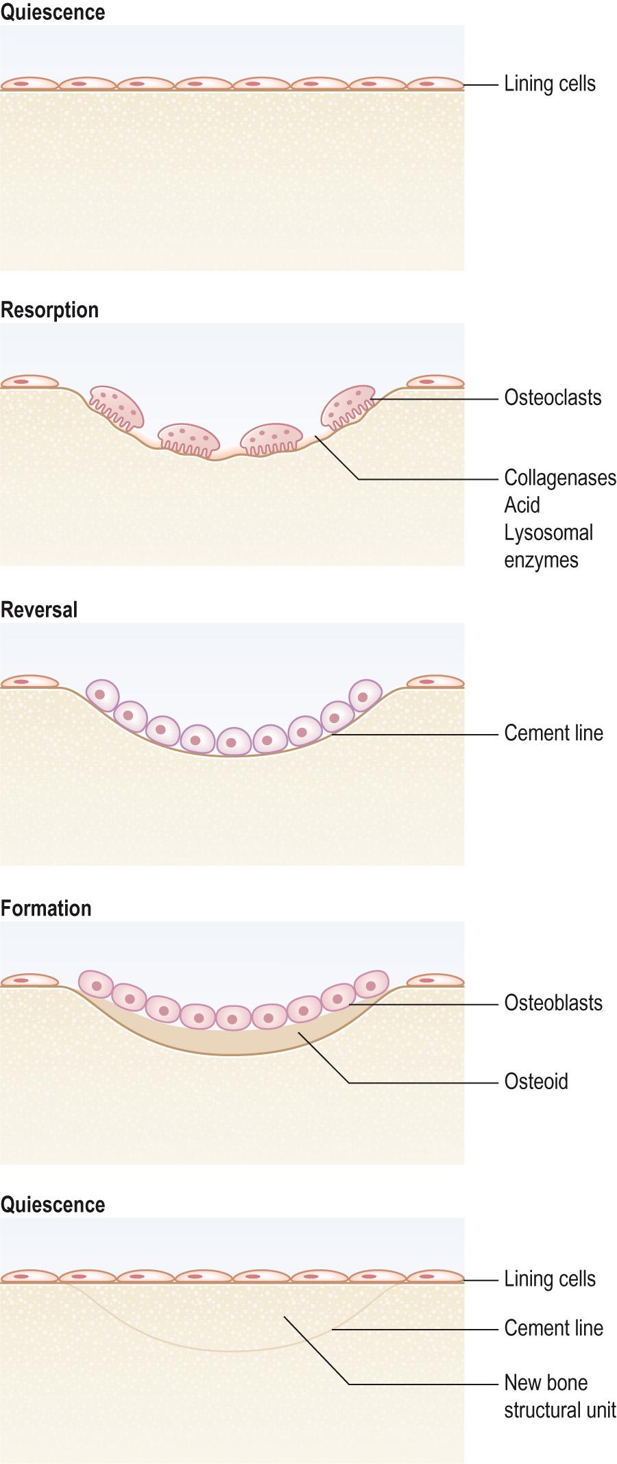 Fig. 9.8, Bone remodelling.