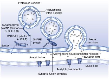 Fig. 60.3, Nerve conduction in the presence of botulinum neurotoxin (BoNT). Vesicle transporting, docking, and membrane fusion are regulated by the soluble N -ethylmaleimide-sensitive factor attachment protein receptor (SNARE) proteins. BoNT subtypes A, C, and E catalyze the cleavage of synaptosomal-associated protein 25 (SNAP-25), while BoNTB, -D, and -F obstruct synaptobrevin function. Damage to any SNARE proteins immobilizes vesicle function and all downstream muscular activity.