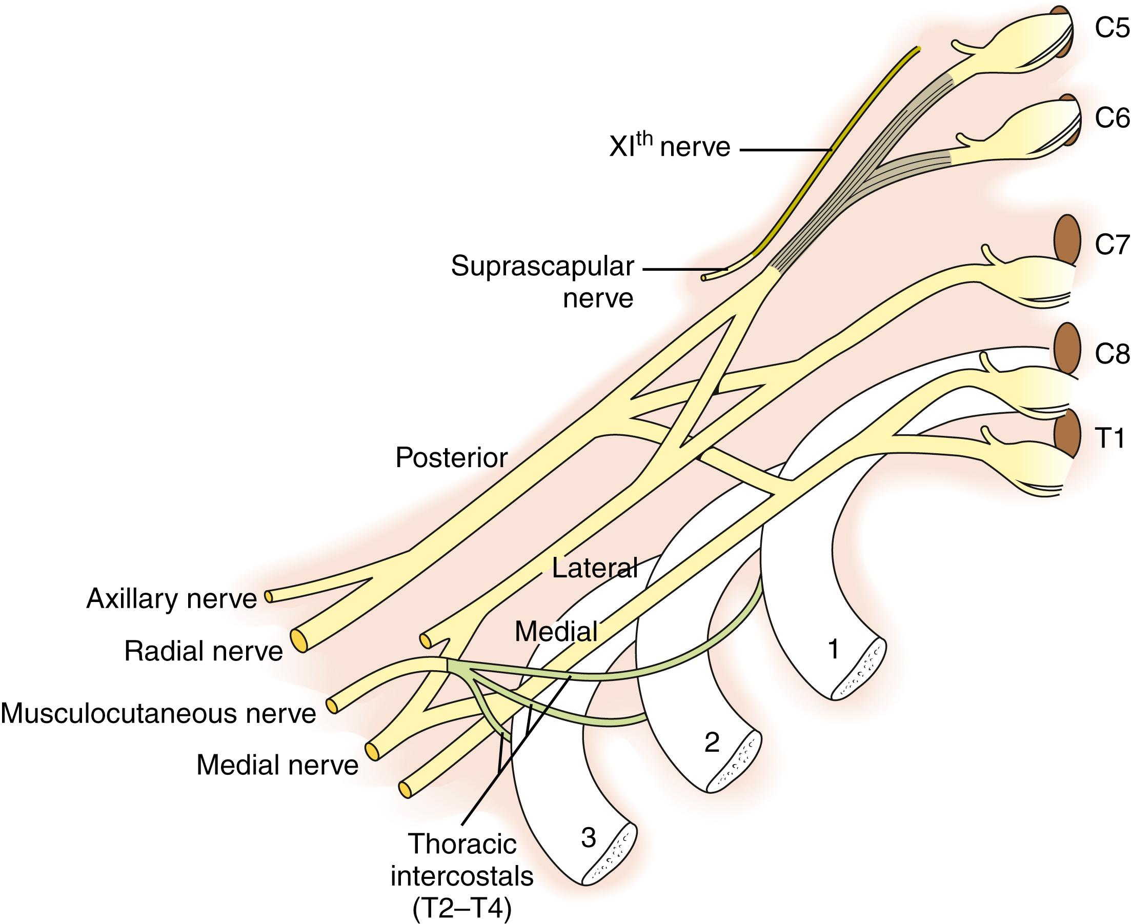 Fig. 40.7, Nerve grafting strategies for nerve transfers and grafts.