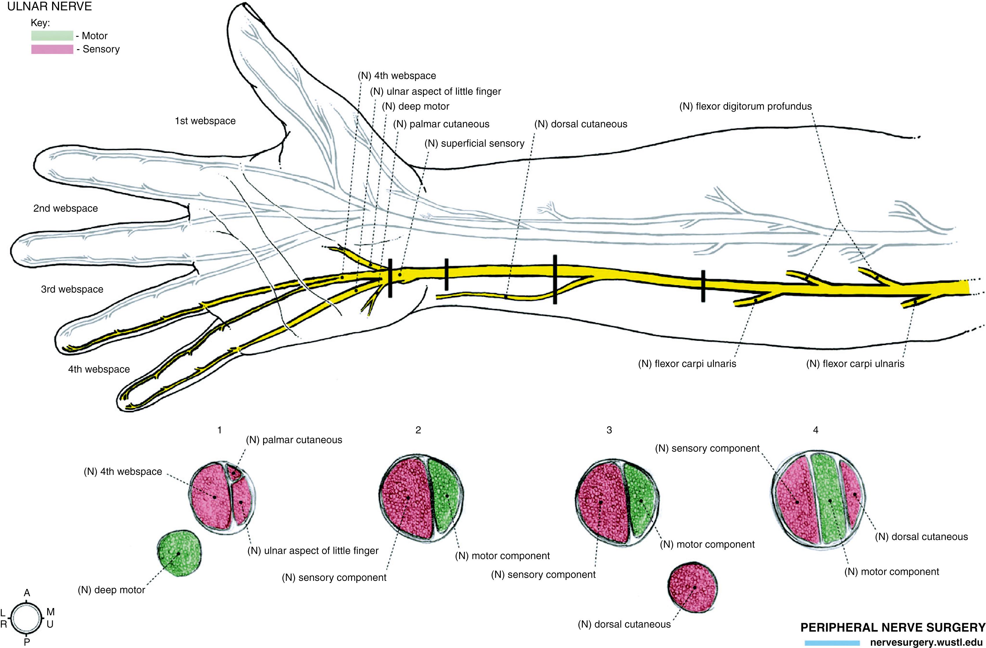 Fig. 53.2, The internal topography of the ulnar nerve.
