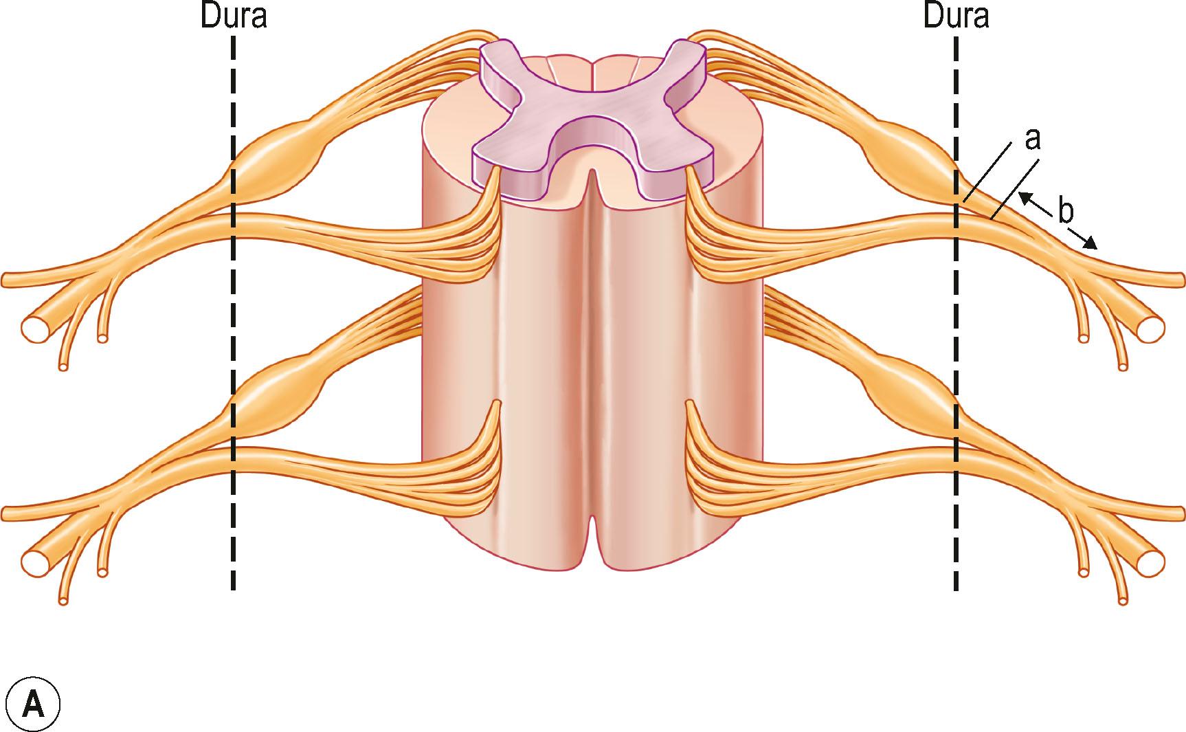 Figure 23.2, (A) The drawing shows that the postganglionic root is part “a”; the postganglionic spinal nerve is part “b” from the anatomy point of view; (B) an avulsion C7 (distal stump) during dissection.