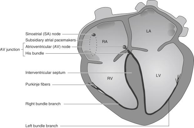 Fig. 133.1, Anatomic structures involved in the generation and propagation of electrical impulses within the heart (i.e., its specialized conduction system).